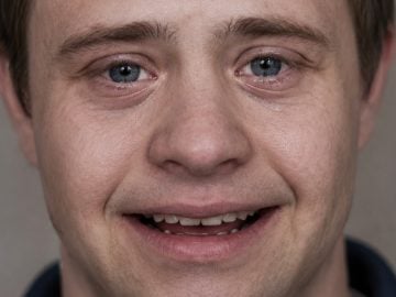 angelmanov syndróm diagnóza ľudia úsmev neustále šťastie