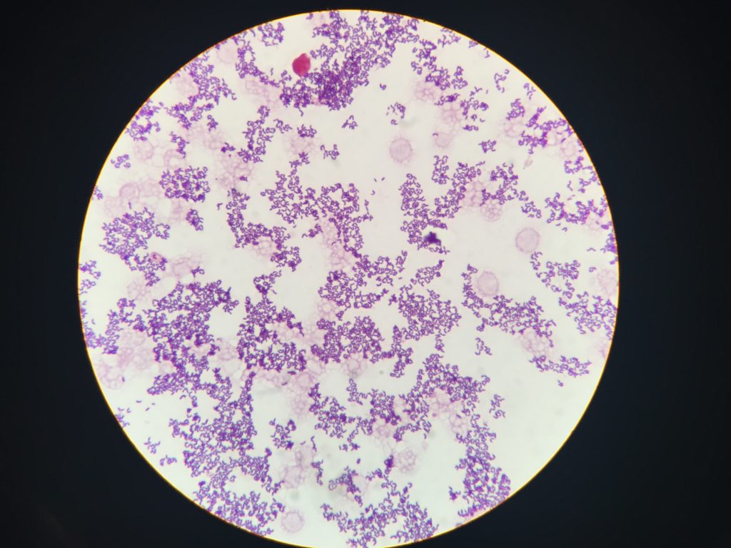 Žena, ktorá sa nakazila baktériou Listeria monocytogenes po tom, čo jedla syrové nite zakúpených od poľského predajcu, zomrela.