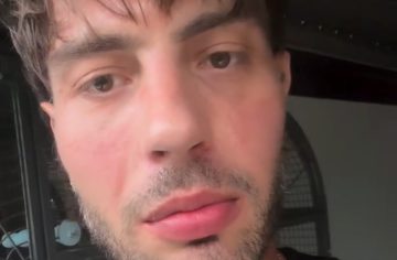 Tomy Kotty sa bráni proti tvrdeniam, že fyzicky týral svoju ex Dominiku. Vo videu ukazuje, ako to celé bolo úplne inak
