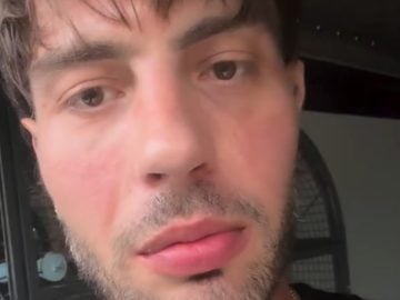 tomy kotty kontroverzia rozpad vzťahu ľudia dominika video