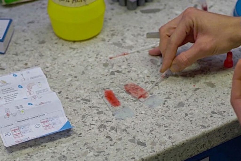 Vedel si, že aj pes môže darovať krv? Šéfka OZ Psí darcovia krvi opisuje, čo sa deje na veterine a vyvracia mýty, ktorým ľudia stále veria
