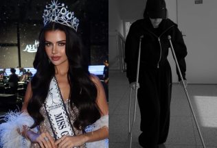 domi alagia súťaž krásy nešťastie zranenie influencerka dominique