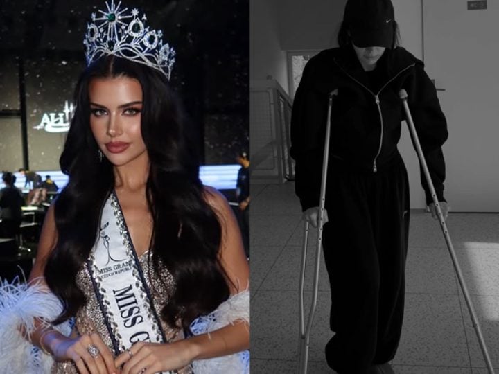 domi alagia súťaž krásy nešťastie zranenie influencerka dominique