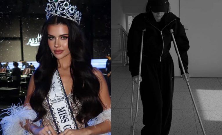 domi alagia súťaž krásy nešťastie zranenie influencerka dominique