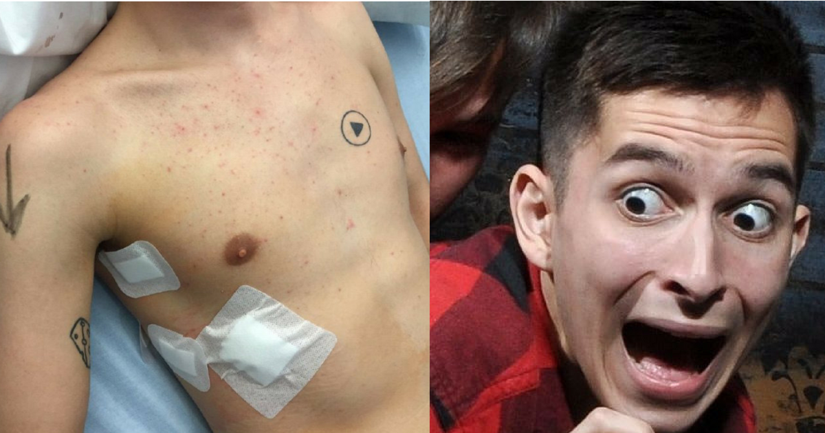 Mladíkove drobné tetovanie sa mu pri operácii takmer stalo osudným!
