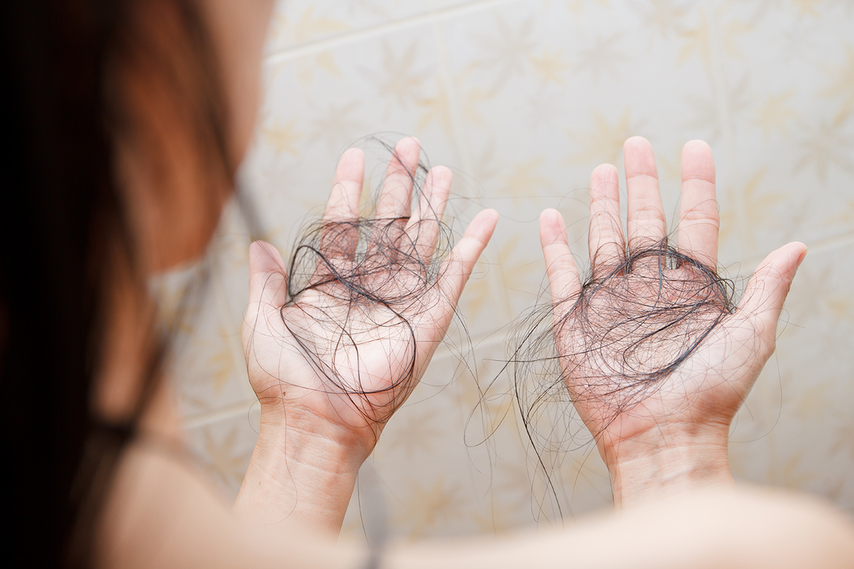 Žena rok zbierala svoje vypadnuté vlasy, aby si z nich mohla vyrobiť príčesky