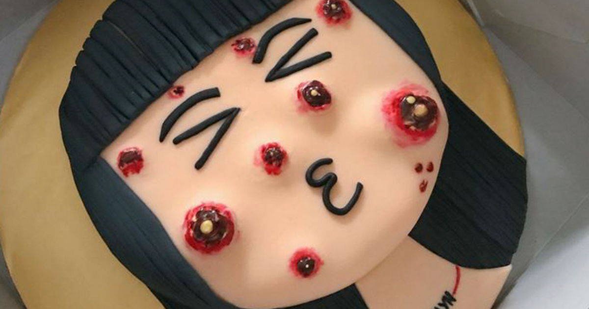 Torta s ozajstnými pubertálnymi vyrážkami sa stala hitom internetu