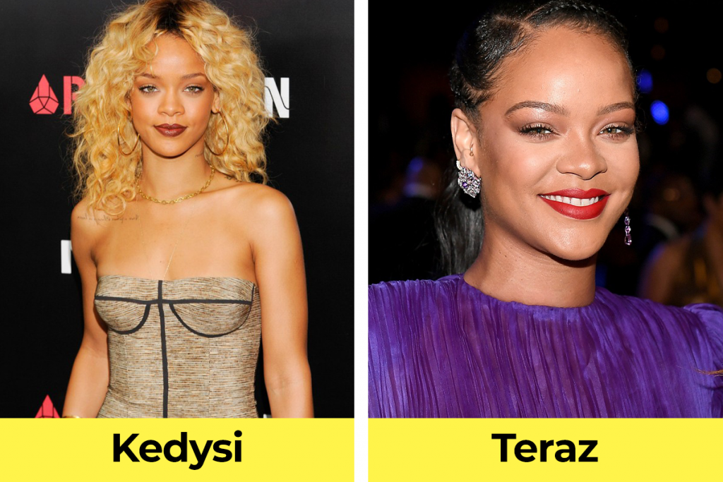 Rihanna na začiatku kariéry vs. teraz