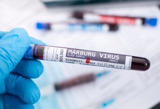 vírus Marburg, biologická zbraň, šírenie vírusu