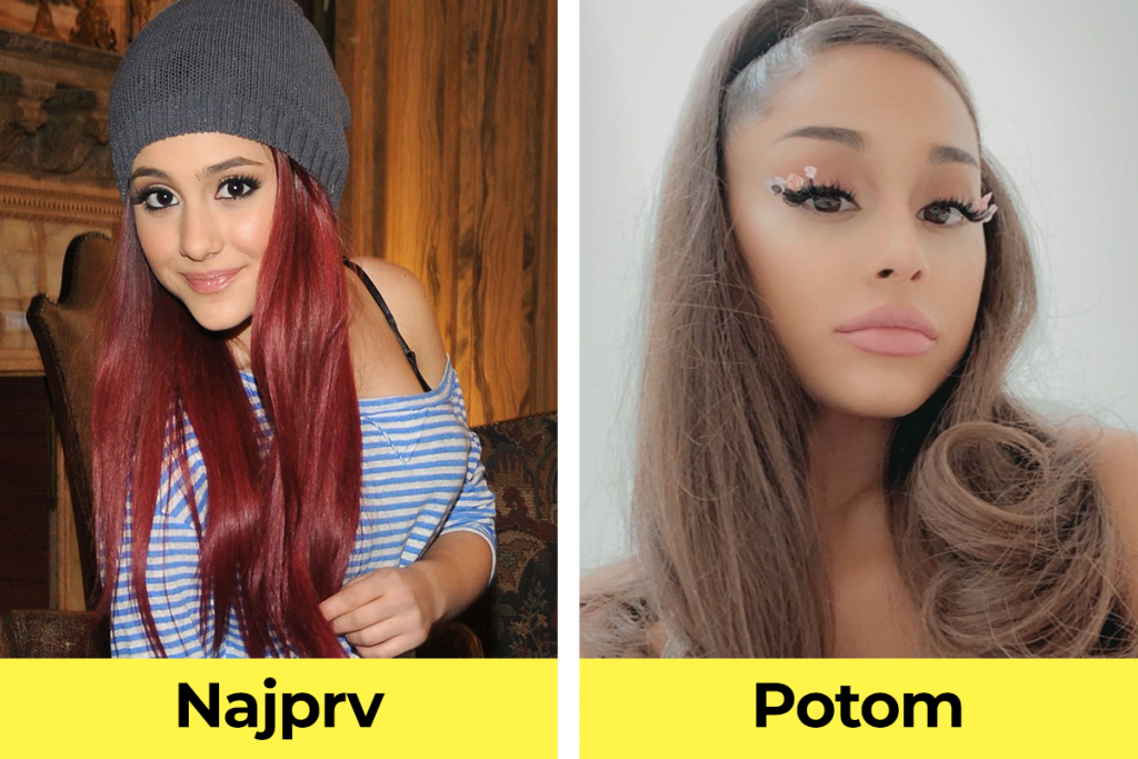 celebrity, známe osobnosti, plastická operácia, pred verzus po plastickej operácii, Ariana Grande