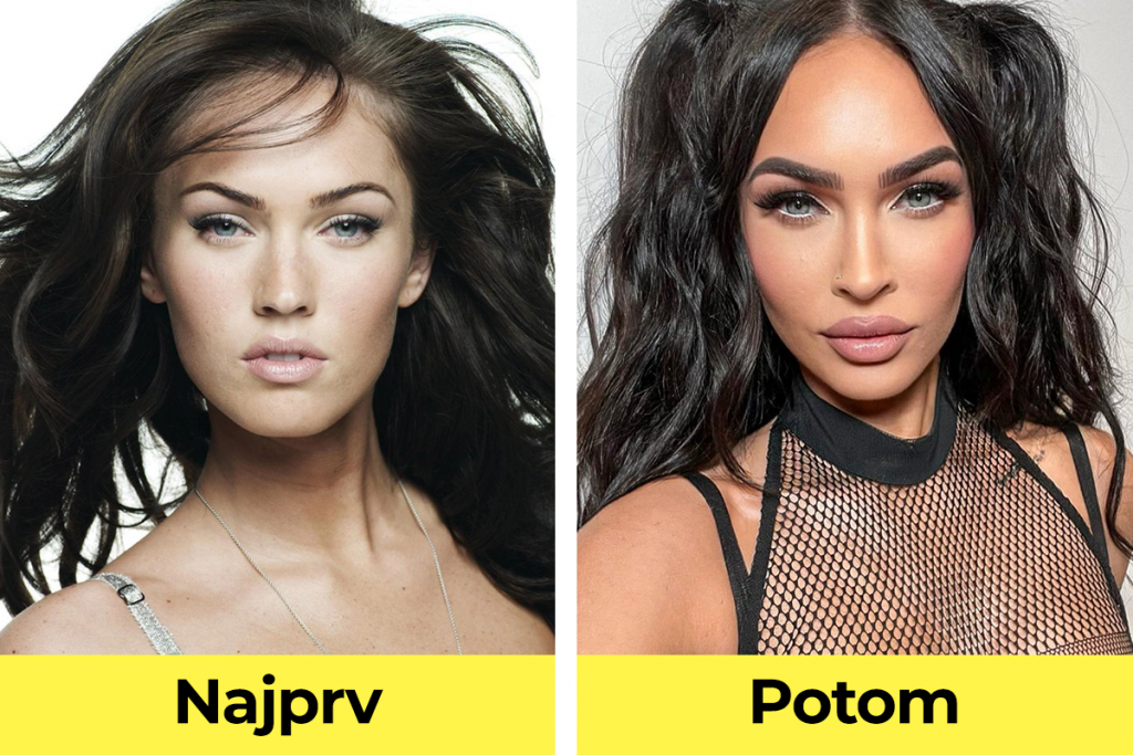 celebrity, známe osobnosti, plastická operácia, pred verzus po plastickej operácii, Megan Fox