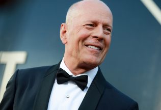 Bruce Willis, zdravotný stav, demencia