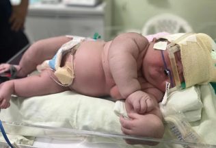 Cleidiane Santos dos Santos, Brazília, obrovské dieťa, novorodenec