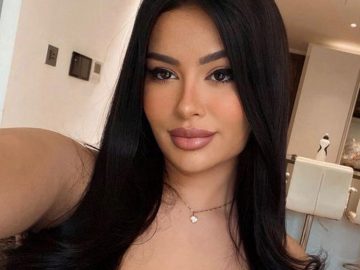 Na plastiky minula už 18-tisíc. Modelka z OnlyFans sa chce podobať na Kylie Jenner